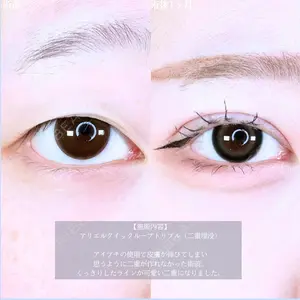 症例