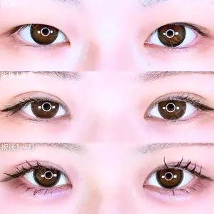 症例