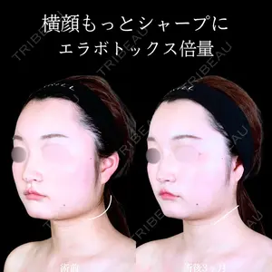 症例