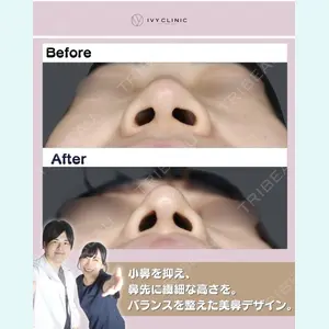 症例