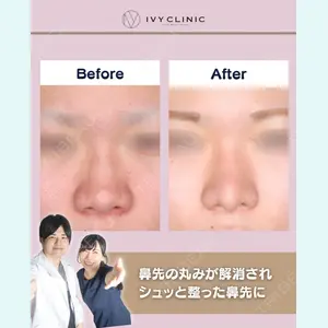 症例