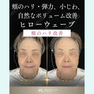症例