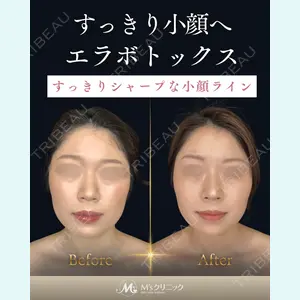 症例
