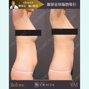 Casa de GRACIA GINZA 【カーサデグラシアギンザ】 樋口 隆男 理事長医師の症例