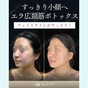 症例
