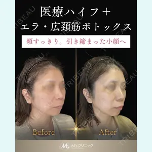 症例