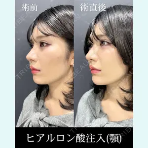 症例