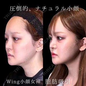 Wing clinic 豊中駅前院 速水 翼医師の症例