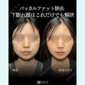 症例