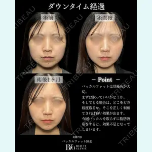 症例