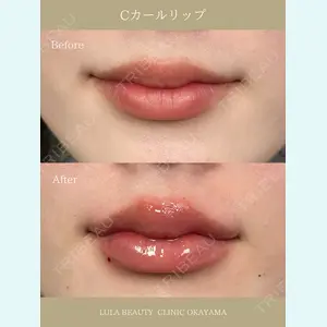 症例