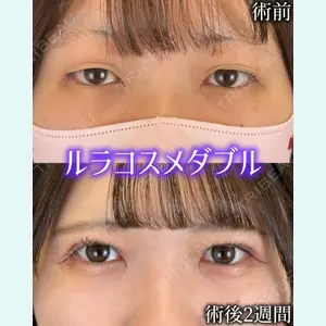 症例