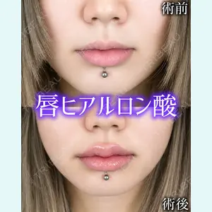 症例