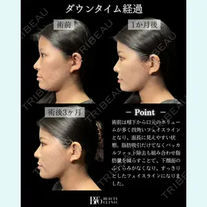症例