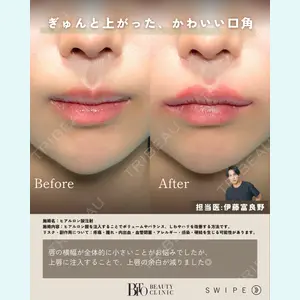 症例