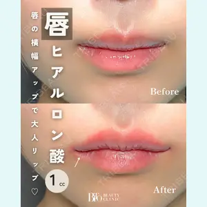 症例