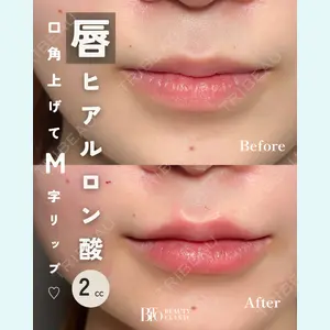 症例