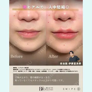 症例