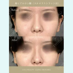 症例