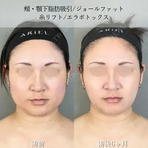 アリエル美容クリニック 大宮院 鈴木　桂介医師の症例
