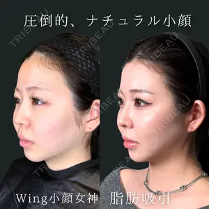 Wing clinic 豊中駅前院 速水 翼医師の症例