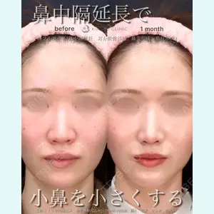 症例