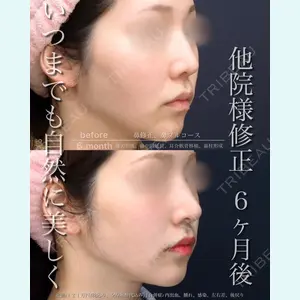 症例