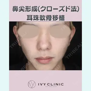 症例