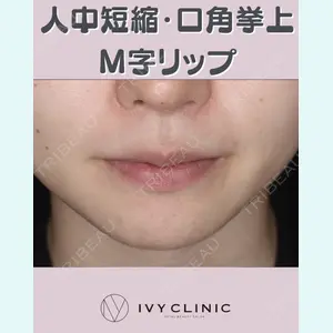 症例