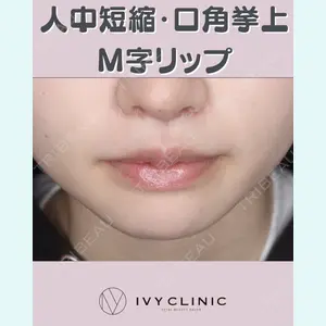 症例