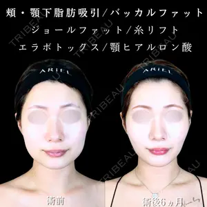 アリエル美容クリニック 大宮院 江郷隼一郎医師の症例