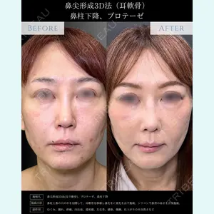 症例