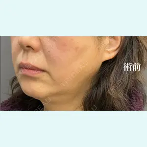 症例