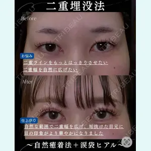 症例