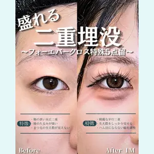 症例