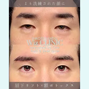 症例