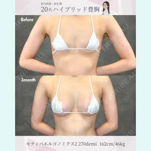 症例