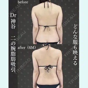 症例