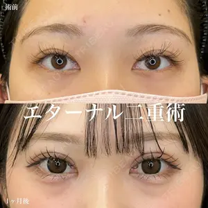 症例