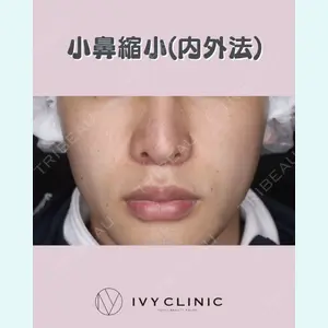 症例