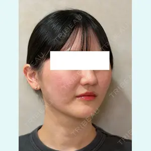 症例