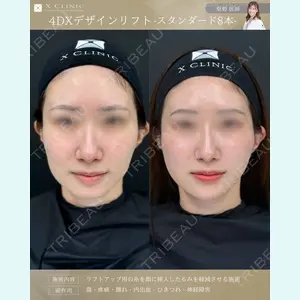 堅野希実医師の症例