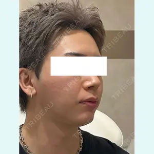 症例