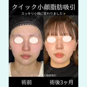 症例