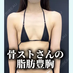 症例