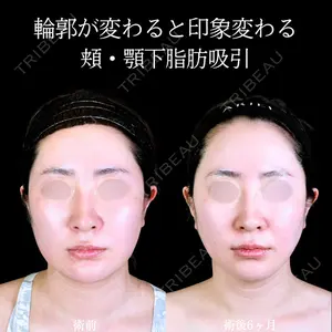 症例
