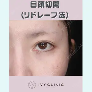 症例