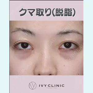 症例