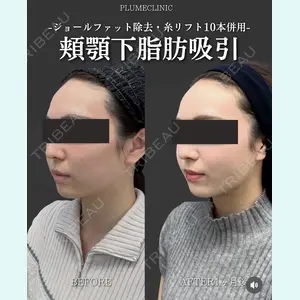 症例