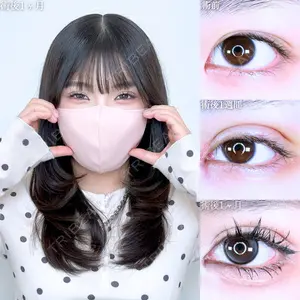 症例